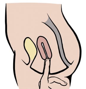 measure cervix height - low