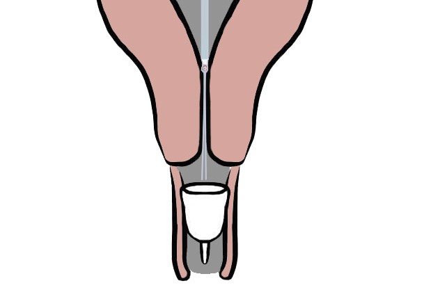 menstrual cup with an IUD close up