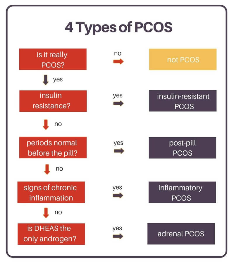 Four types of Polycystic Ovary Syndrome (PCOS) illustrated by visual blockst and text descriptions.
