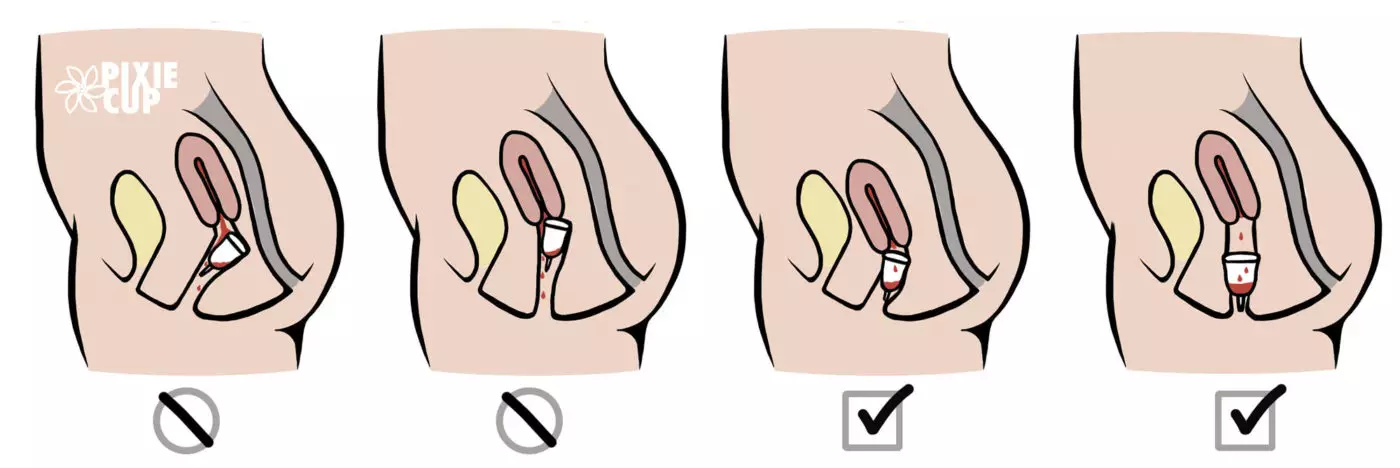 How Do I Use A Menstrual Cup With A Tilted Uterus Pixie Cup
