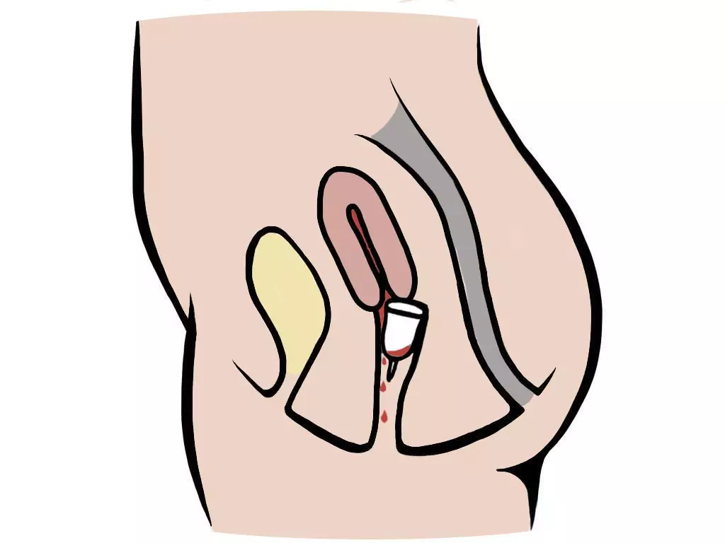 How To Stop Menstrual Cup Leaking Pixie Cup