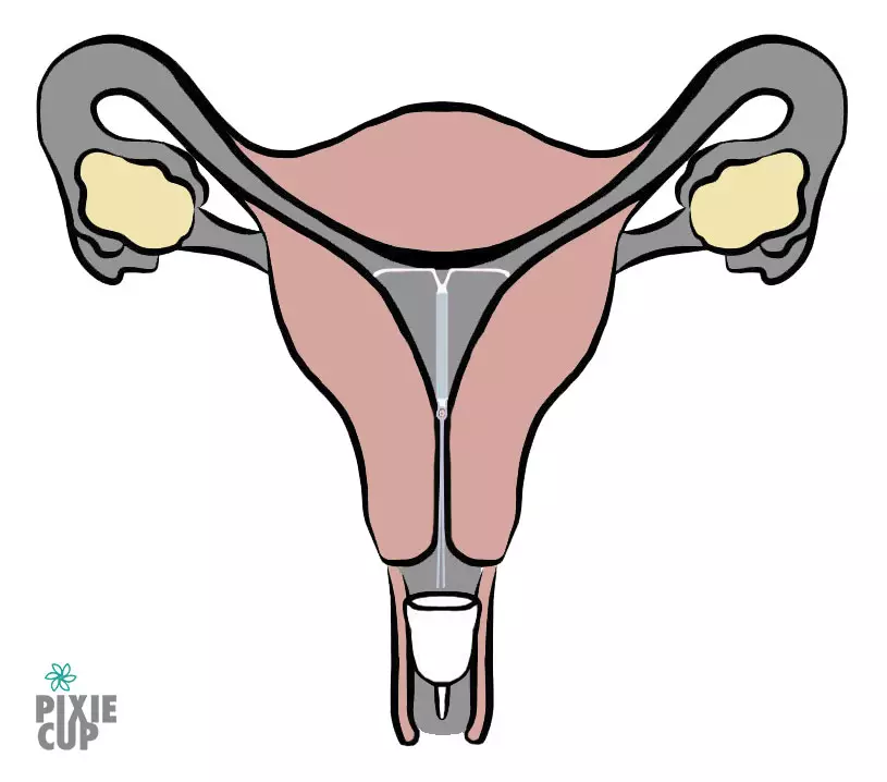 Can you use a Menstrual Cup with an IUD? Pixie Cup